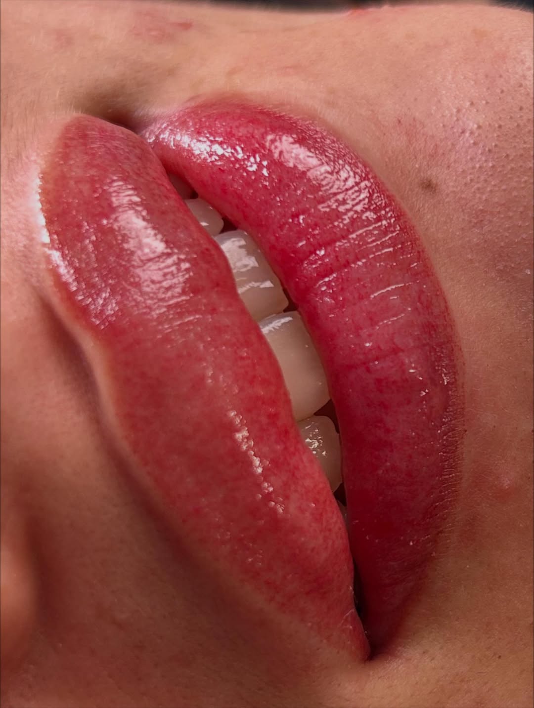 NA-NO Li-PS BDB 👄🔥#ɴᴀɴᴏʟɪᴘs (3)